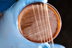 Swabbing on HV agar